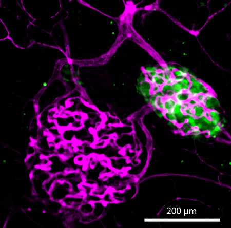 hydrogel-islet