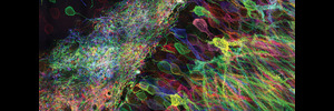 Nanoscale Analysis of Brain Chemistry and Structure